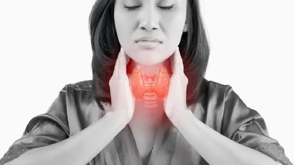 Thyroid