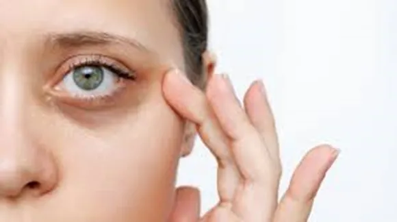 how to get rid dark circles at home