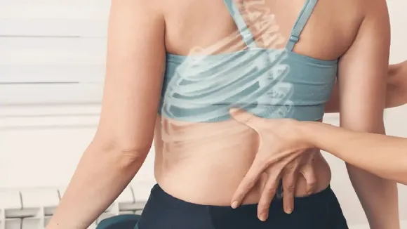 Lordosis