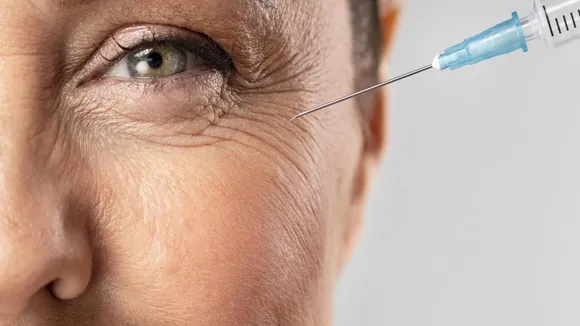 Botox treatment