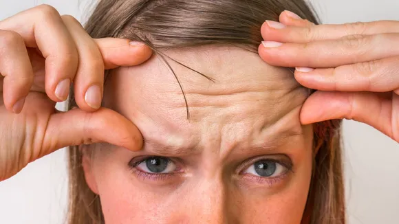 Round mark in the middle of the forehead