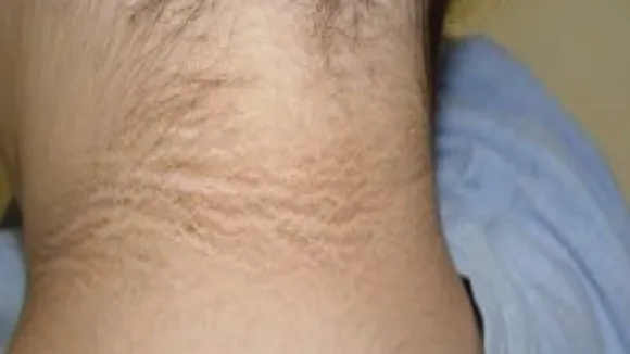 dark neck