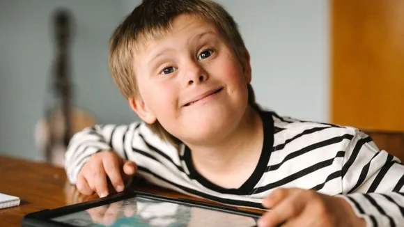 Down syndrome