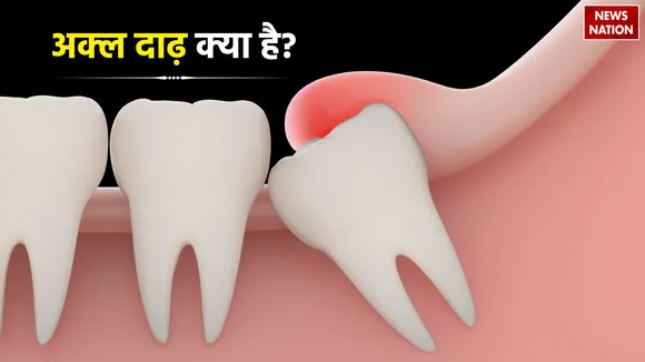 wisdom teeth pain