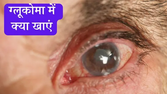 Glaucoma Diet
