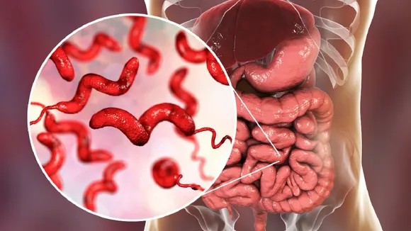Campylobacter Infection