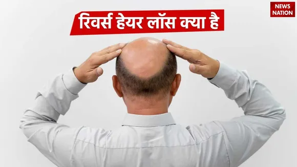 What is Reverse Hair Loss