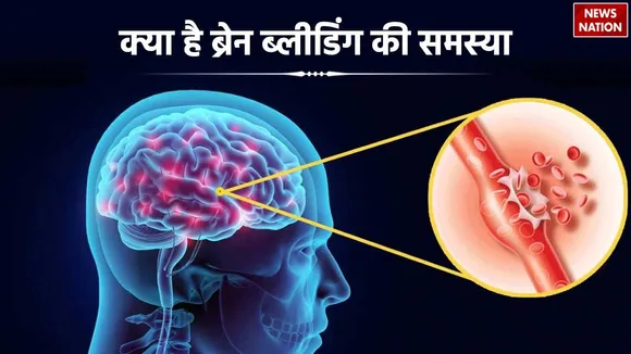 what is brain bleeding