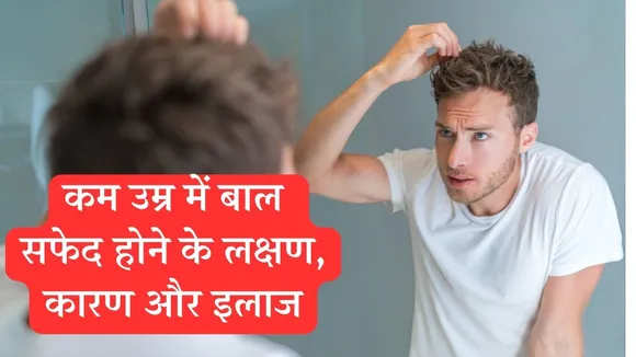 White Hair Problem In Young Age