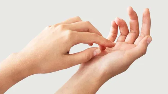 Itching palm signs
