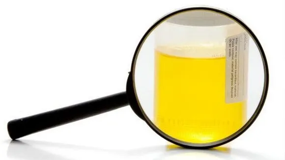 Foamy Urine causes symptoms in hindi