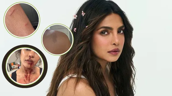 Priyanka Chopra covered in blood