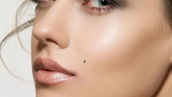mole on face