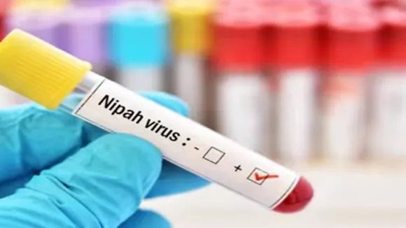 Nipah virus