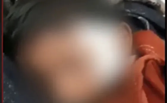 लखनऊ के निजी स्कूल में छात्र को छात्रा ने मारा चाकू