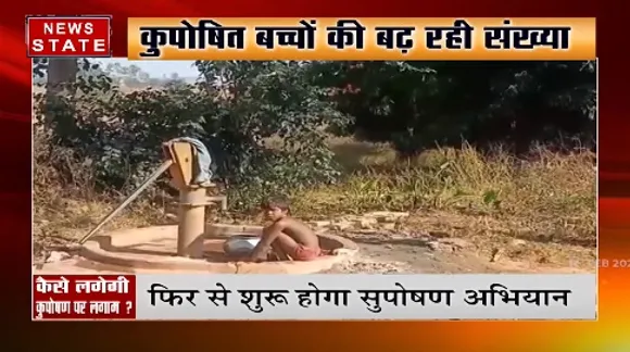MP News : कैसे लगेगी कुपोषण पर लगाम  ?