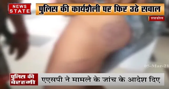 शहडोल पुलिस की कार्यशैली पर फिर उठे सवाल, युवक की बेहरमी से की पिटाई | News State MP CG