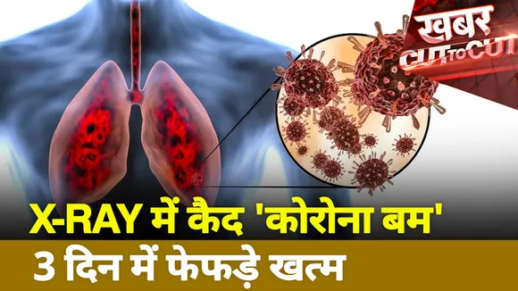 X-RAY में कैद 'कोरोना बम' 3 दिन में फेफड़े खत्म