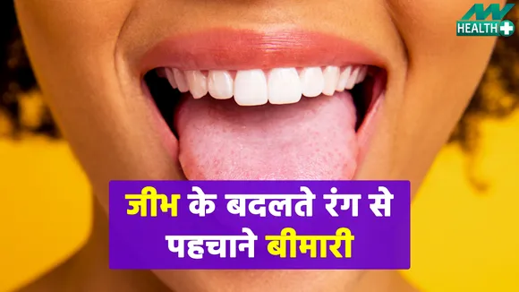 अब जीभ के बदलते हुए रंग से करें जीभ के बदलते रंग से जानें अपनी बीमारी | tongue color chart| tongue disease|