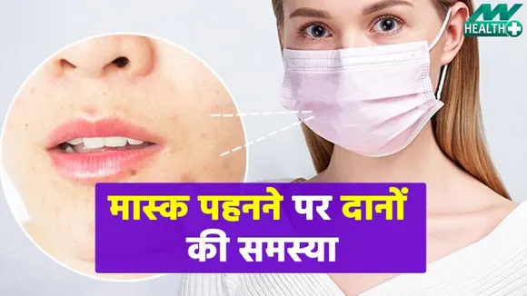 कोरोना में मास्क लगाने होते पिंपल्स, तो ऐसे करें दूर