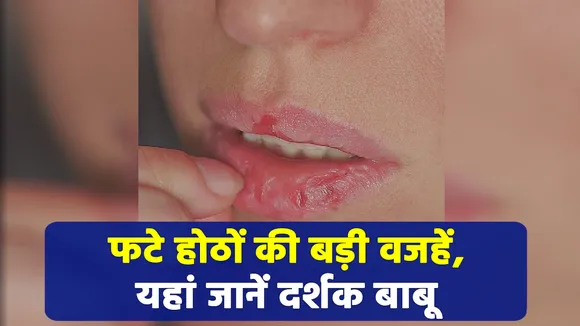 सिर्फ सर्दी से नहीं इन 5 अनजान रीज़न्स से फटते हैं आपके होंठ