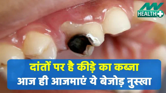 दांतों पर है कीड़े का कब्जा, आज ही आजमाएं ये बेजोड़ नुस्खा