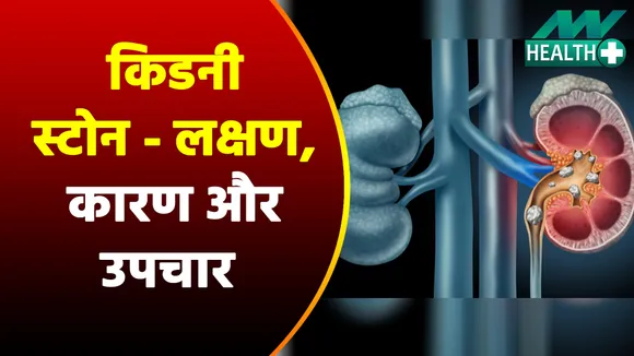 किडनी स्टोन  - लक्षण, कारण, जांच, और उपचार