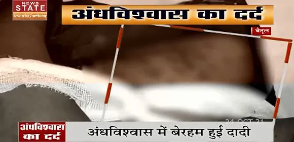 इलाज की जगह गर्म सलाख , अंधविश्वास की हैरतअंगेज कहानी