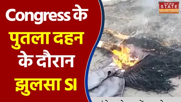 पुतला दहन के दौरान झुलसा SI, Congress पर लगा आरोप