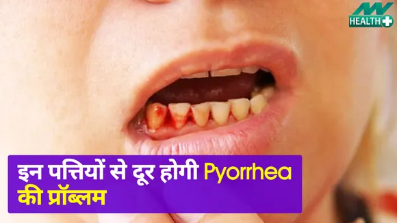 Health Tips : Pyorrhea की प्रॉब्लम होगी दूर, इन पत्तों को चबाने से हुजूर