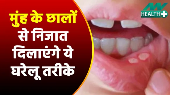 मुंह के छालों मिलेगा निजात, ये घरेलू तरीके हैं लाजवाब |Mouth Ulcers Home Remedies|Health Care Tips|