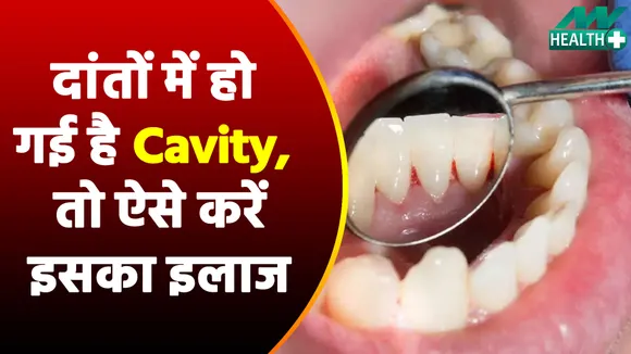 दांतों की कोई समस्या हो, इस तरीके से मिलेगा छुटकारा, नहीं होगी Cavity