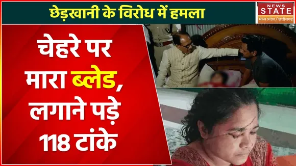Bhopal News : छेड़खानी का विरोध करने पर चेहरे पर मारा ब्लेड, CM Shivraj ने पीड़िता से की मुलाकात