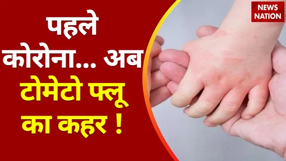 Tomato Flu : जानिए क्या है टोमेटो फ्लू के लक्षण