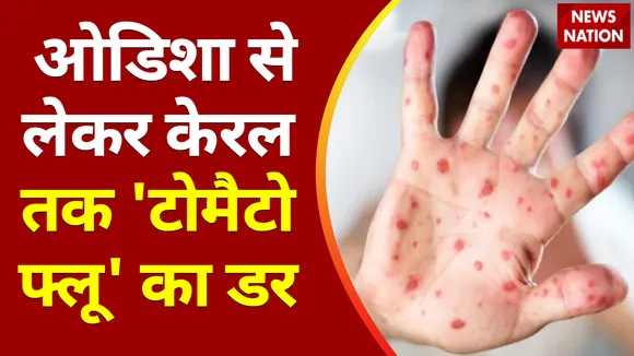 Tomato Flu : ओडिशा से लेकर केरल तक 'टोमैटो फ्लू' का डर