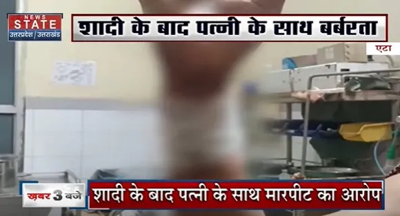 Uttar Pradesh News : एटा - थानाध्यछ की पत्नी का गंभीर आरोप, शादी के बाद पत्नी के साथ बर्बरता