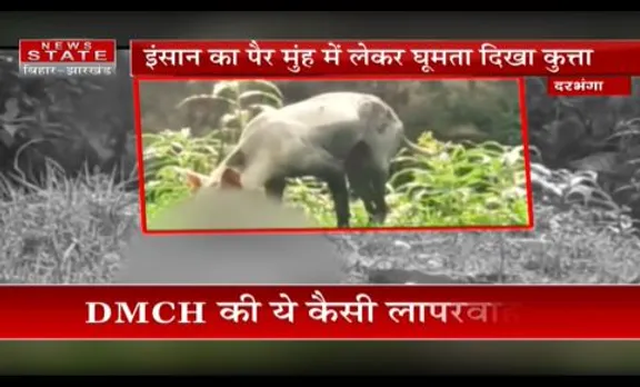 Bihar News : दरभंगा में DMCH की अजीबोगरीब लापरवाही