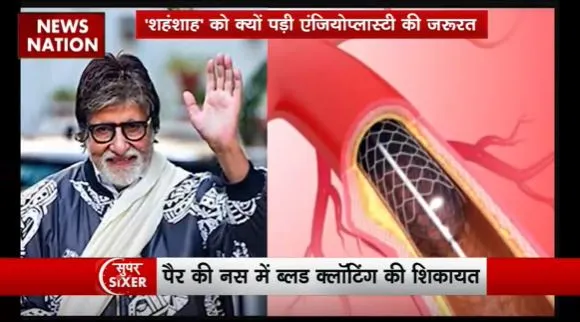 Super Sixer : बॉलीवुड के महानायक अमिताभ बच्चन अस्पताला में एडमिट