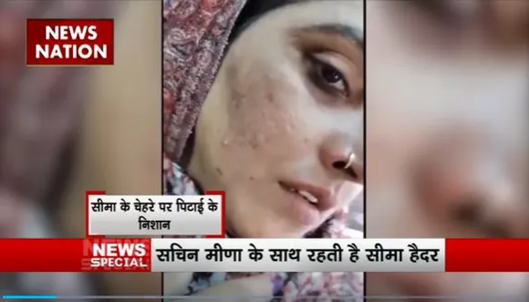 Seema Haider : सीमा हैदर के चोट वाले वीडियो पर उठे सवाल