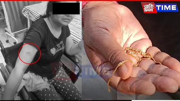 Woman Stabbed During Chain Snatching Attempt in Guwahati