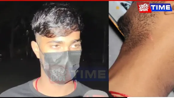Visitor Alleges Assault At Guwahati Zoo By Intoxicated Employee