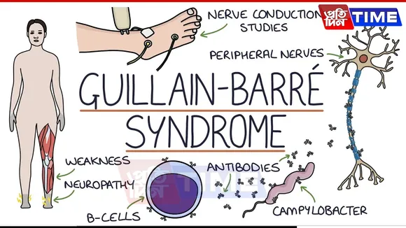 Maharashtra Reports 167 Guillain-Barre Syndrome Cases, 7 Deaths Under Probe