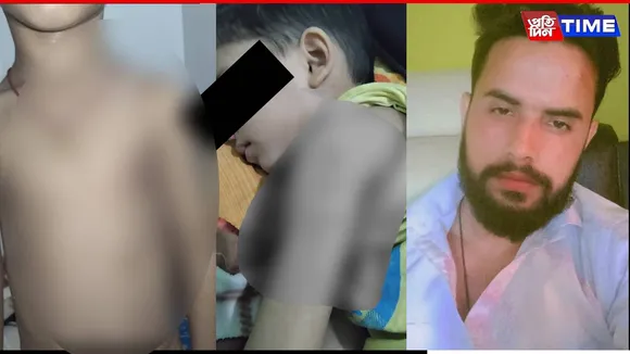 Assam Man Accused of Torturing Stepson, Mother Alleges Police Inaction