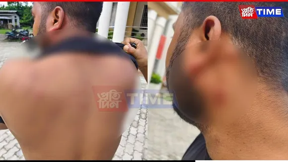 Journalist Attacked After Reaching Conflict Zone: Coincidence or Call?