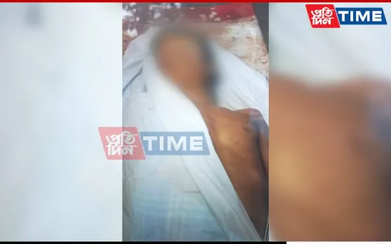 Guwahati: Basistha Flyover Worker Electrocuted to Death