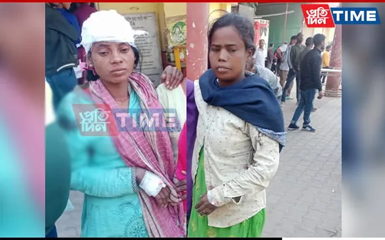 Assam: 3 Critically Injured After Getting Stuck in Crusher Machine