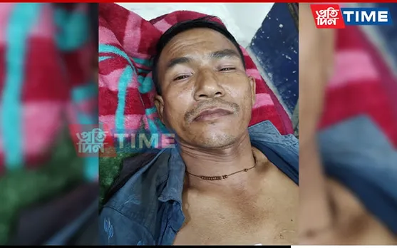 Assam: Civilian Mistaken for Poacher Shot in Baksa