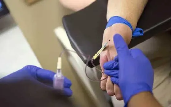Jaundice Outbreak in North Guwahati; 11 More Cases Reported