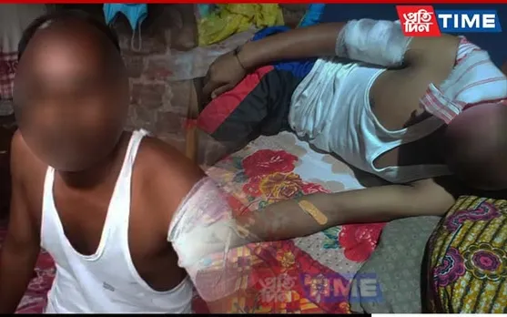 Miscreants Brutally Attack Rickshaw Puller & Son with Lethal Weapon in Guwahati