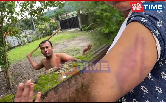 Wife of YouTuber from Assam’s Bongaigaon Attacked with Wooden Stick